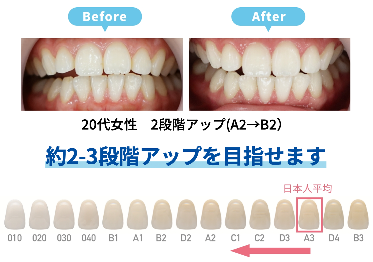 ホワイトエッセンス